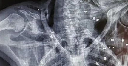 母猩猩身中74弹倒下，双眼失明、孩子脱水而死，凶手仍未找到