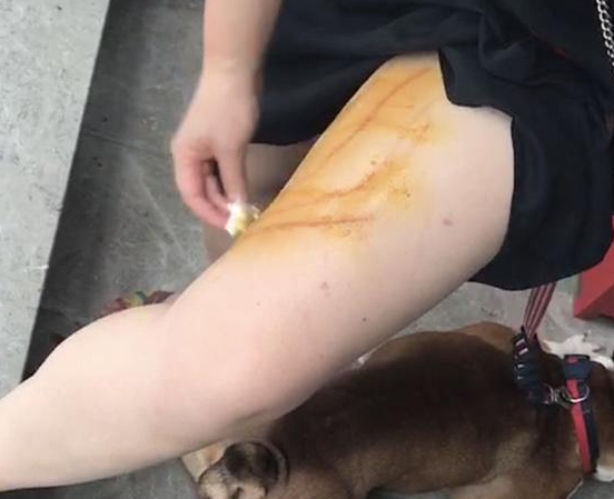 阿拉斯加咬伤人，被猛打10分钟，导致口腔开裂！ 