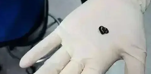 金鱼生病带去做手术，最后一问治疗费用，顿时肠子都悔青了！
