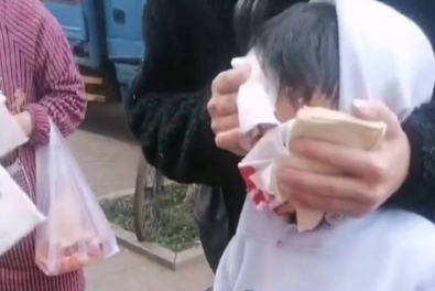 男童遭狗扑咬，面部缝90多针！家长：这只狗前后咬伤了13人！警方：还在找狗主人 