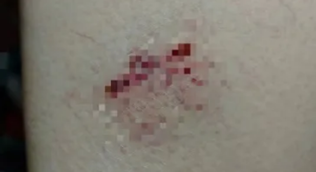 上海一女子被邻居家的狗咬伤，邻居：赔钱也不牵绳
