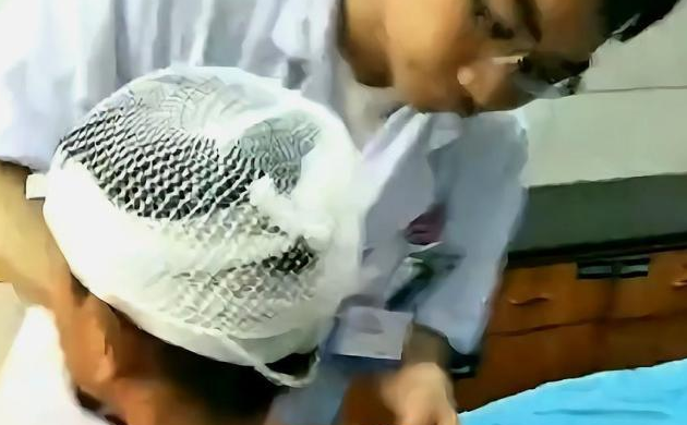 江西吉安一8岁男童在街头被一只狗扑倒咬伤，脸部伤口长达15厘米